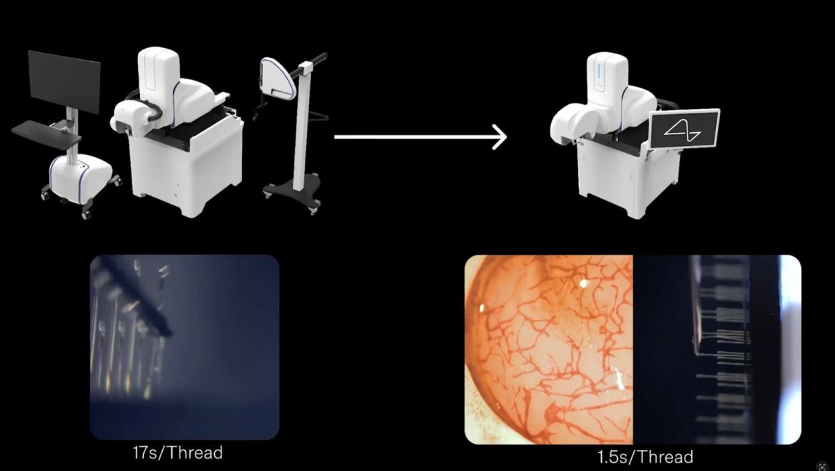 عاجل | Neuralink تستعد لأول زراعة لشريحة تعيد البصر